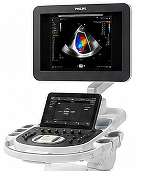 Philips EPIQ CVx 초음파 장비 — 모니터에 컬러 도플러 심장 영상이 표시된 모습